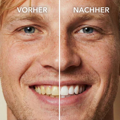🔥UP TO 50 OFF- BUY MORE SAVE MORE🔥Tooth Polish - Instant Clean Smile