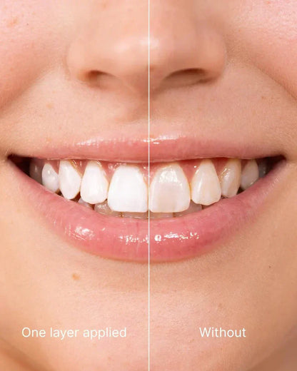 🔥UP TO 50 OFF- BUY MORE SAVE MORE🔥Tooth Polish - Instant Clean Smile